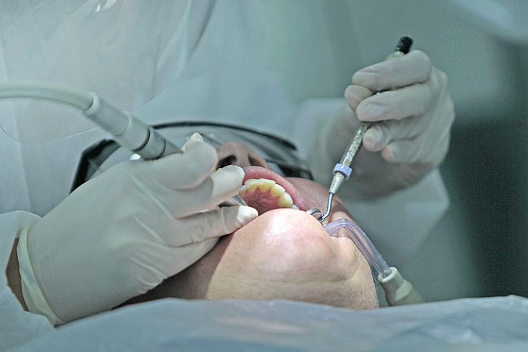 Câmara debate riscos do mercúrio em tratamentos odontológicos