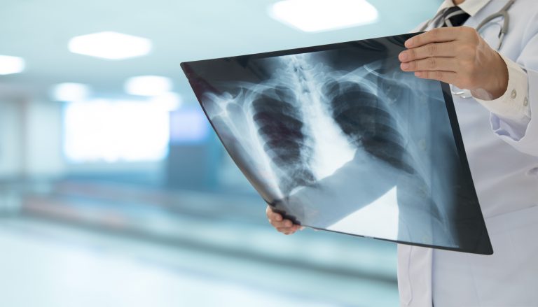 Lei cria Setembro Roxo para conscientizar sobre fibrose cística
