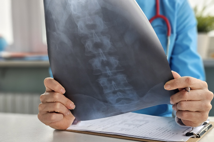 TST garante indenização a operador com doença reconhecida após demissão